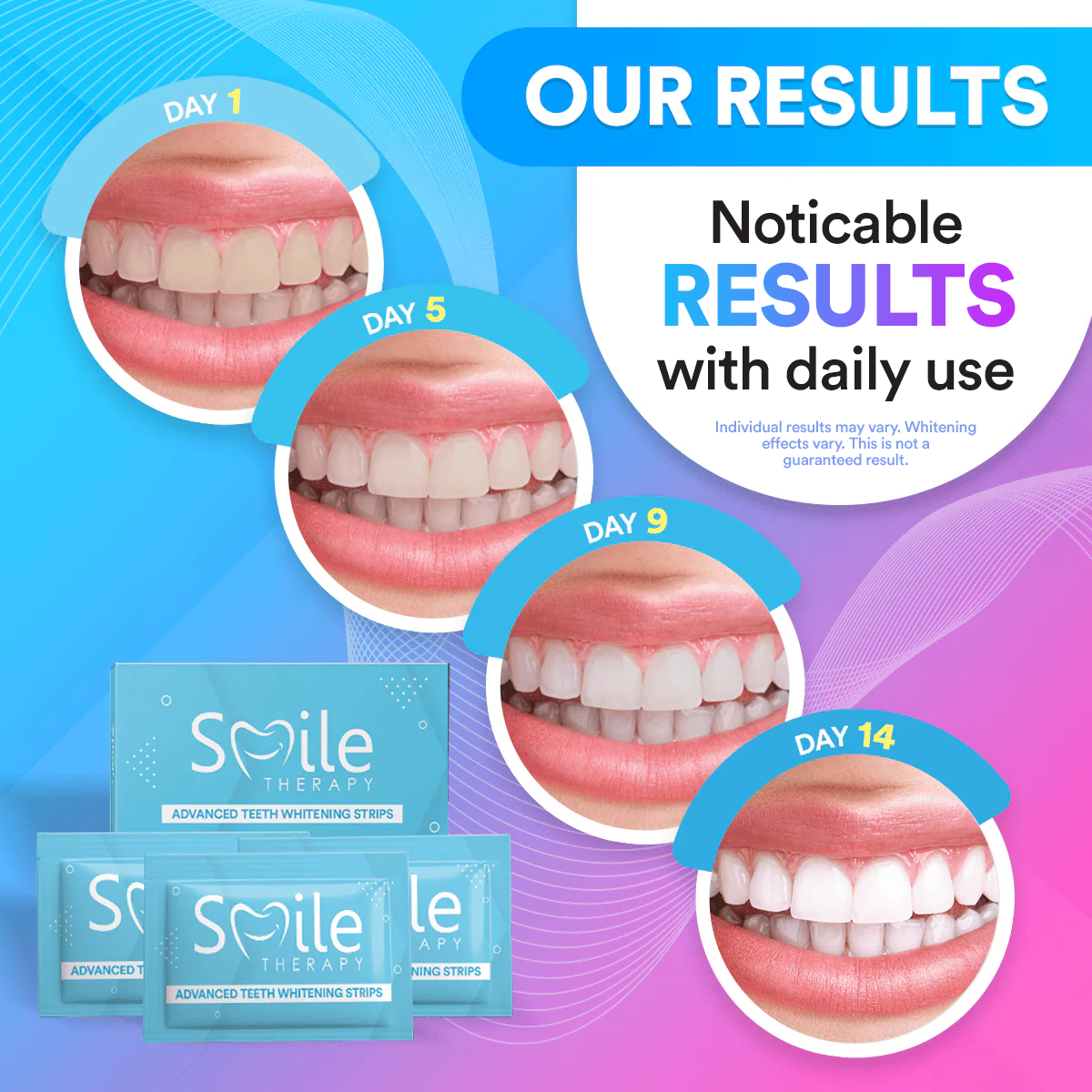 Advanced Teeth Whitening Strips (14 Treatments)