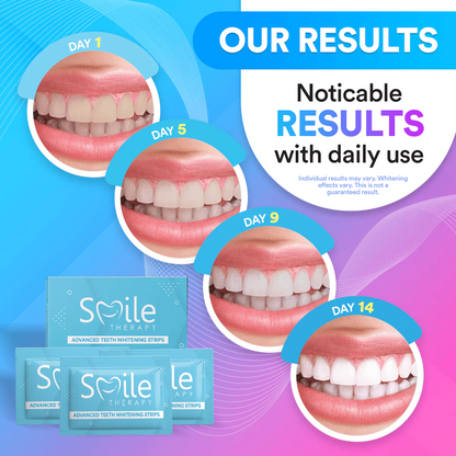 Advanced Teeth Whitening Strips (14 Treatments)