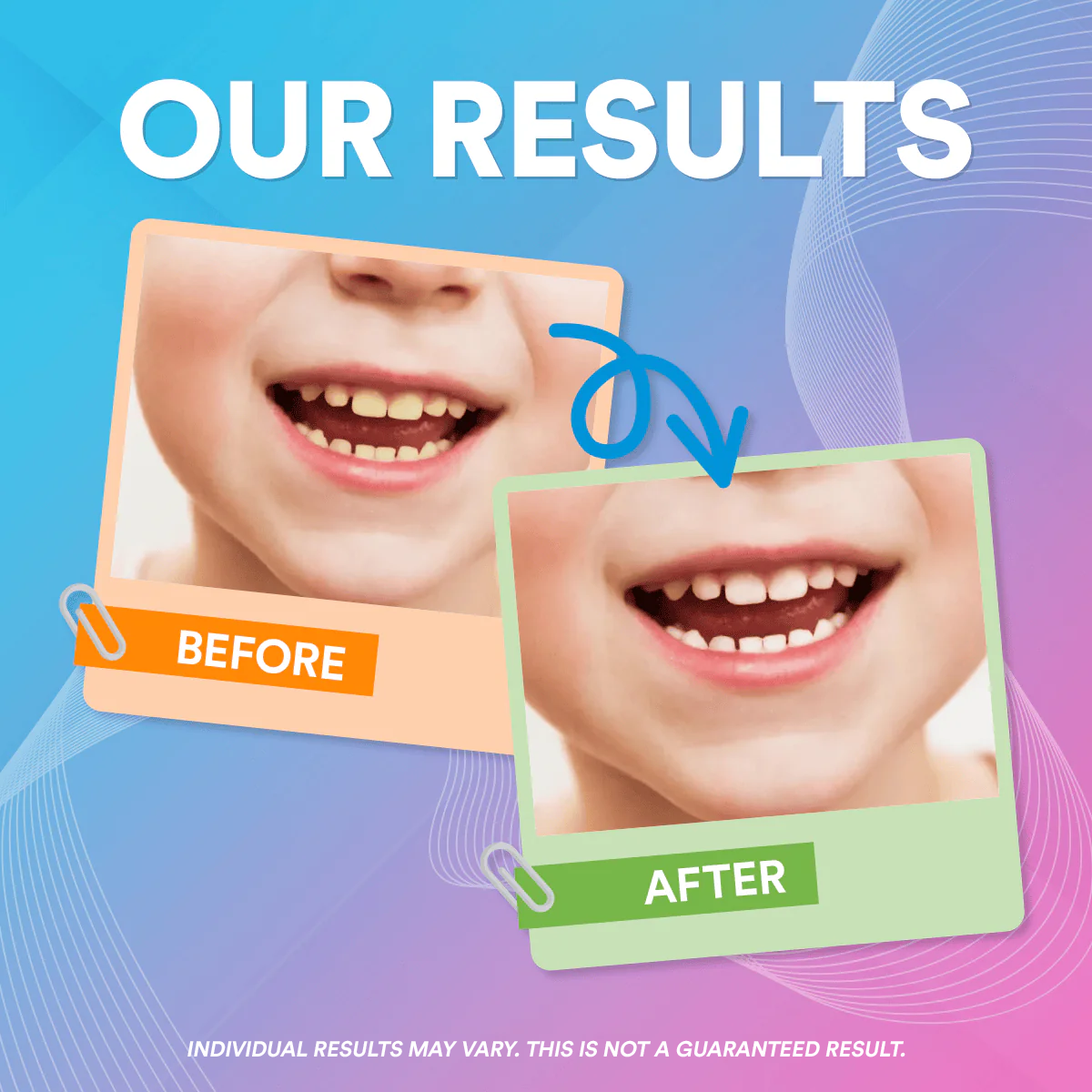 4-In-1 Kids Sonic Water Flosser