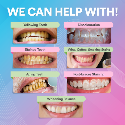 PAP+ Teeth Whitening Powder