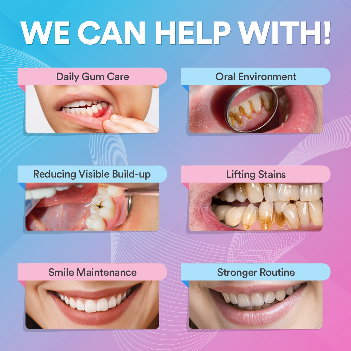Ultrasonic Tooth Cleaner