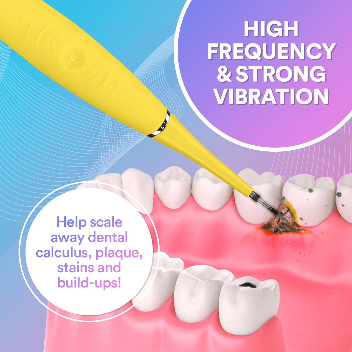 Ultrasonic Tooth Cleaner