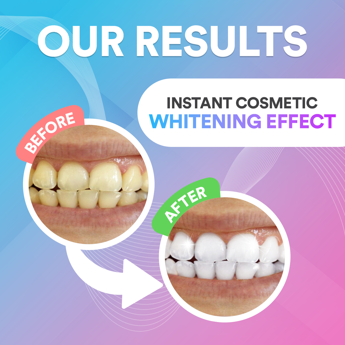 Teeth Whitening Pen