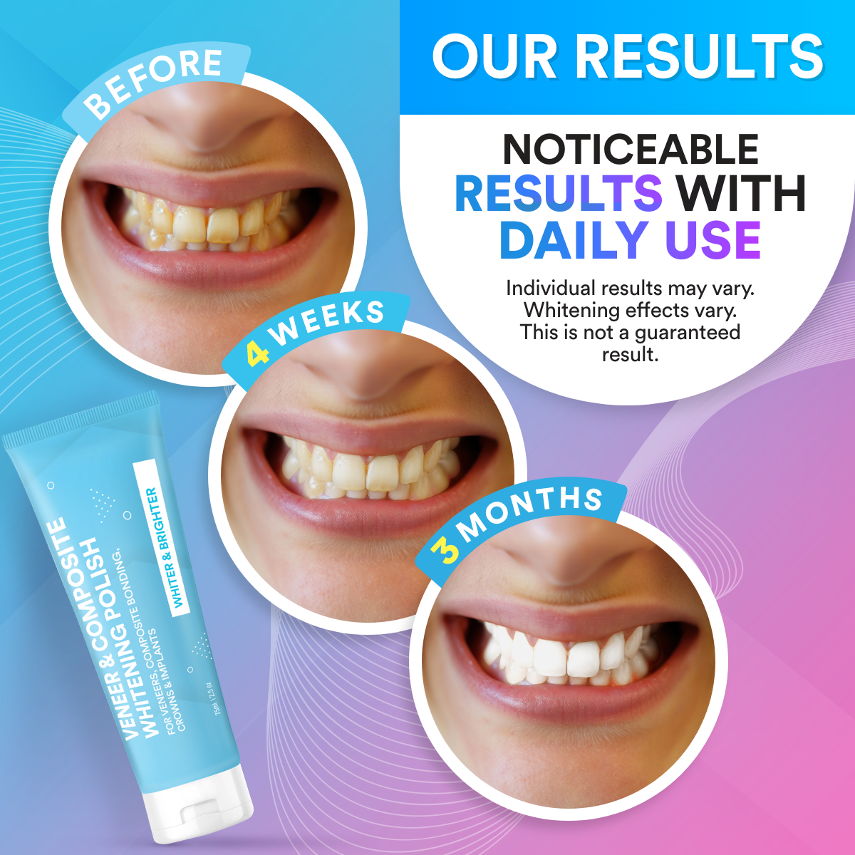 Veneer & Composite Whitening Polish Toothpaste